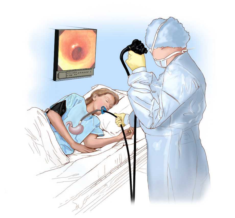 Что такое гастроскопия: подготовка, обезболивание, ход процедуры
