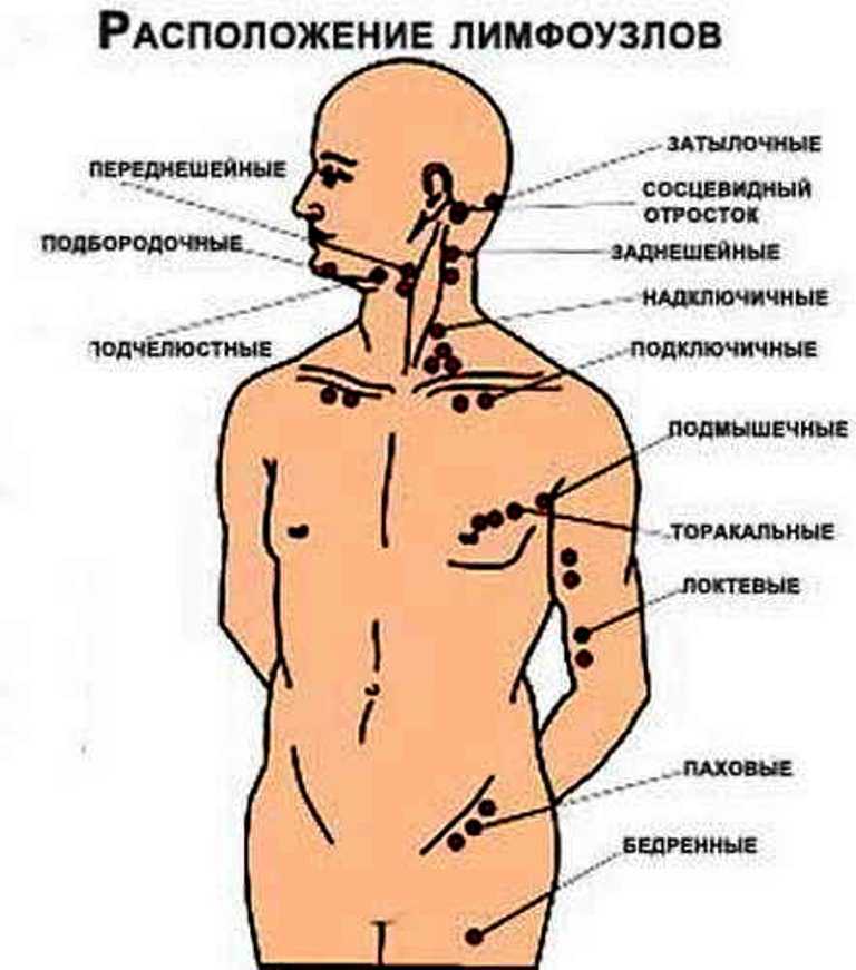 Лимфоузлы у мужчины схема. Лимфатические узлы человека схема расположения. Лимфатические узлы на теле человека схема у мужчин. Где находятся лимфатические узлы у человека фото. Схема лимфоузлов на теле человека на шее.