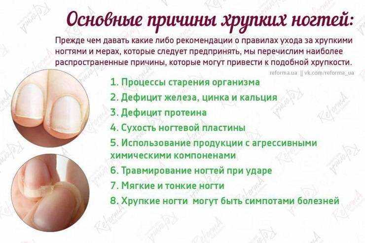 Ногти слоятся и ломаются — что делать? укрепляющие ванночки для ногтей: рецепты