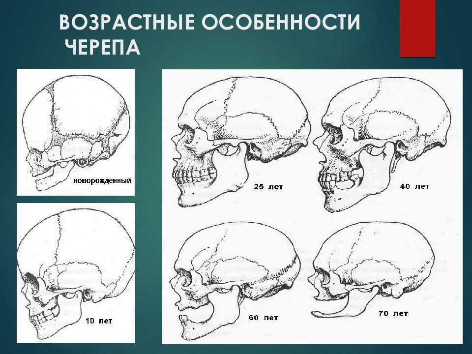 Черепная аномалия. Возрастная анатомия черепа. Возрастные и половые особенности черепа. Изменение черепа с возрастом.