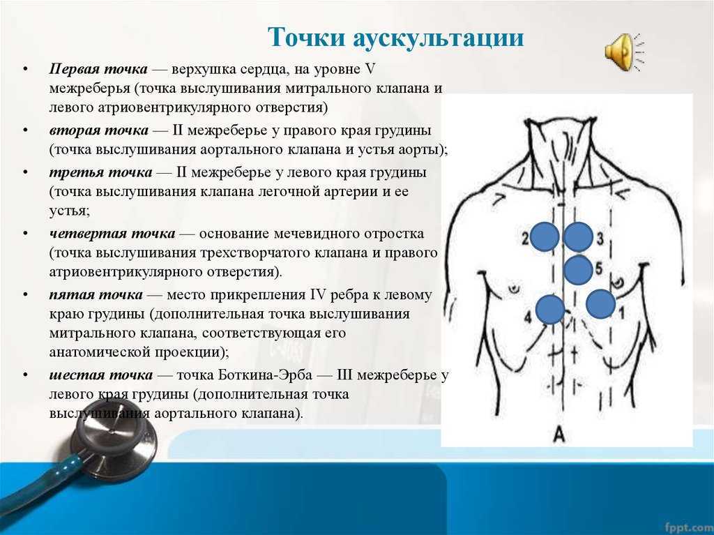 Шум остина флинта выслушивается в точке обозначенной на рисунке цифрой