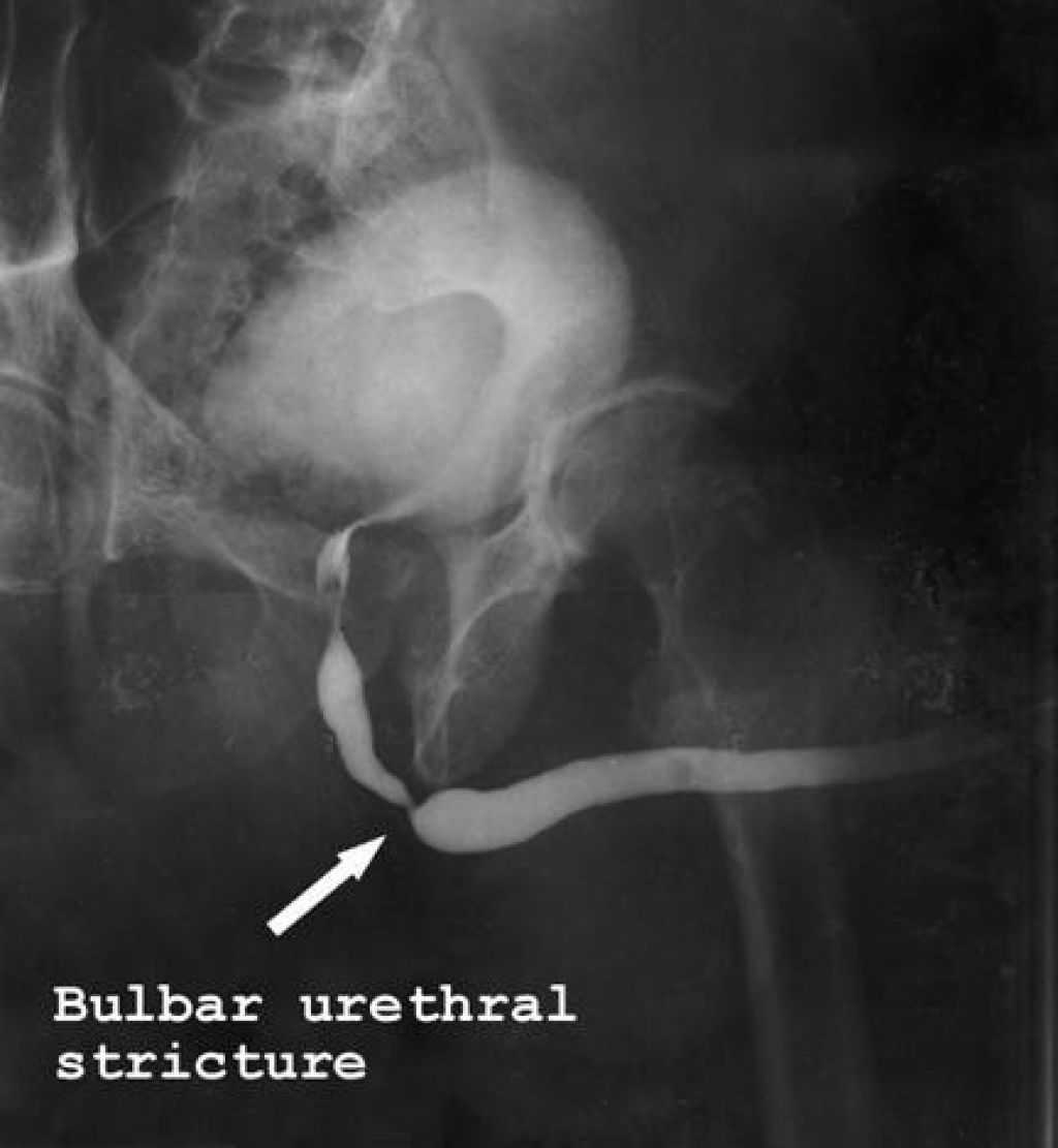 Retrograde urethrogram cpt code