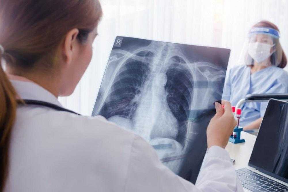 Туберкулез: симптомы, причины, формы, признаки