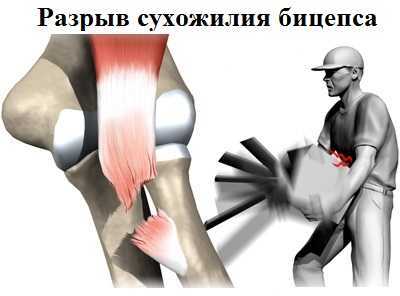 Двуглавая мышца плеча m Biceps brachii имеет две головки - короткую и длинную