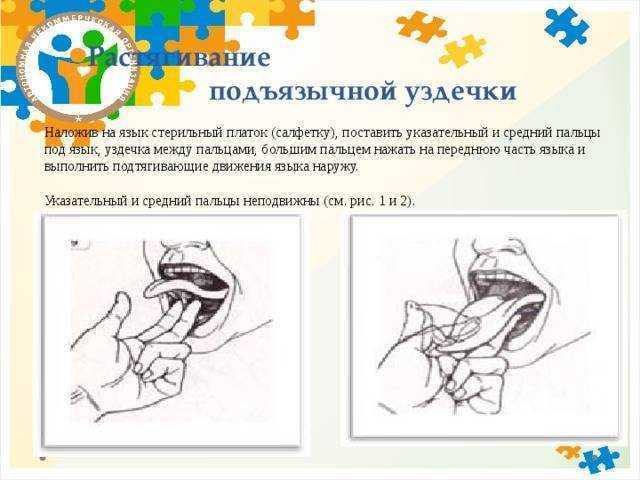 Артикуляционная гимнастика для растягивания подъязычной уздечки в картинках