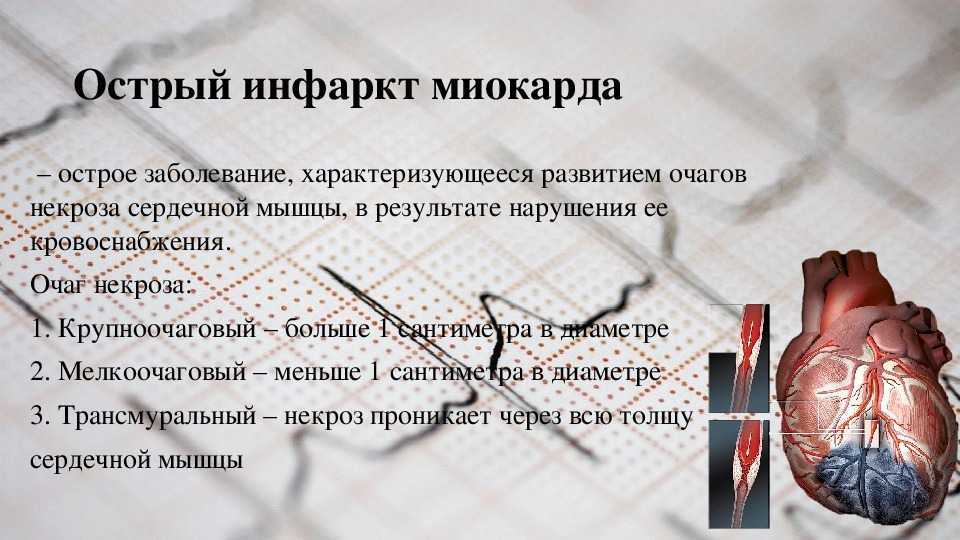 Инфаркт что это такое. Трансмуральный инфаркт миокарда осложнения. Крупноочаговый инфаркт миокарда. Крупноочаговый и мелкоочаговый инфаркт миокарда. Мелкоочаговый инфаркт.