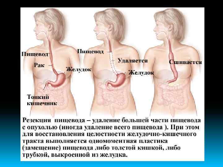 Посттравматический синдром