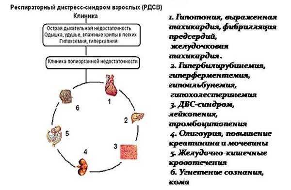 Орви и простуда