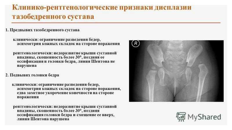 Цервикальный мазок: его значение для женского здоровья