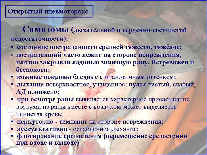 Пневмоторакс: симптомы, лечение | eurolab | пульмонология
