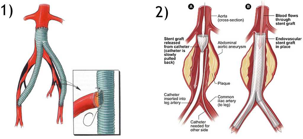 Строение суставов свободной нижней конечности. нормальная анатомия человека: конспект лекций