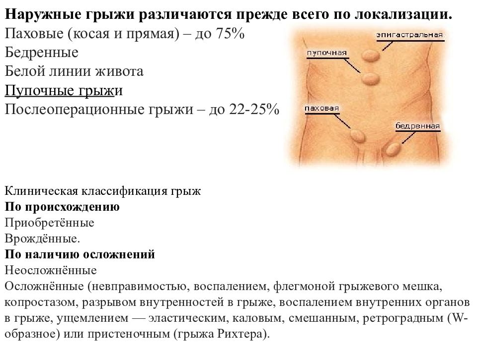 Грыжа белой линии живота карта вызова смп