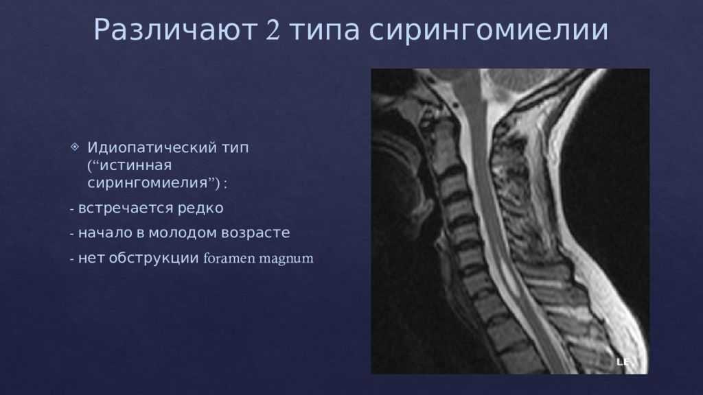 Аномалия арнольда-киари, платибазия, аномалия развития. лечение - нейрохирургическая консультация.