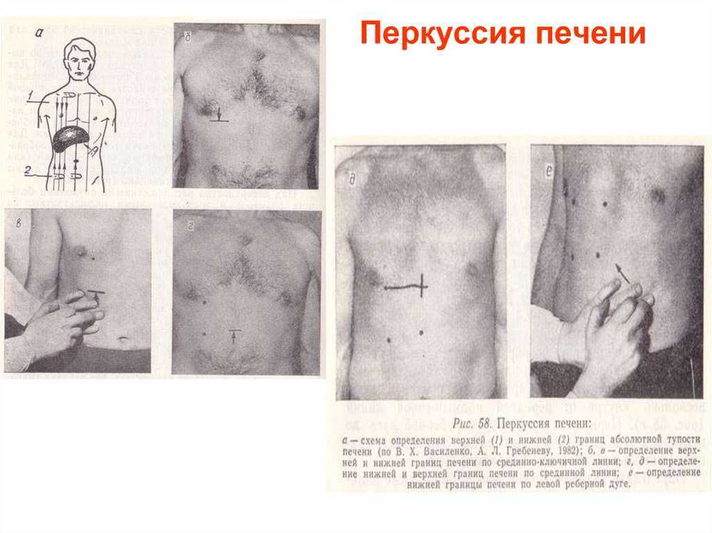 Пальпация печени, селезенки и почек