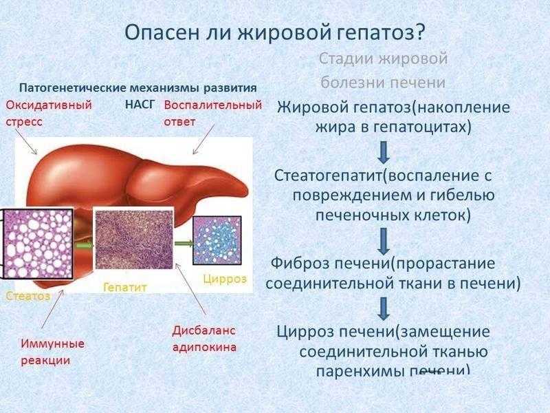 Стеатогепатоз. Жировой гепатоз стадии. Стадии жирового гепатоза. Клинические стадии жировой гепатоз. Жировой гепатоз печени симптомы.