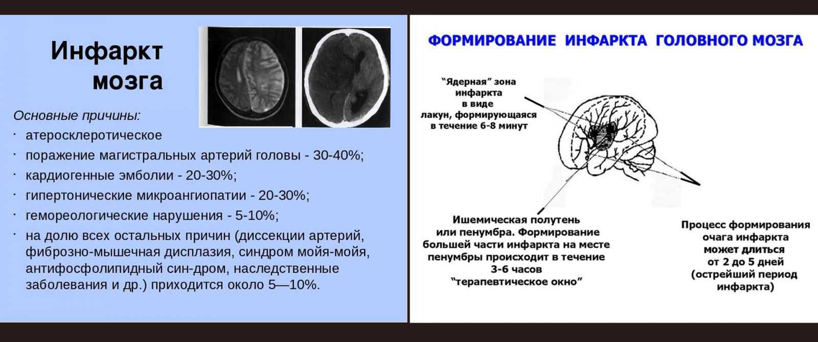 Диагностика и лечение заболеваний головного мозга