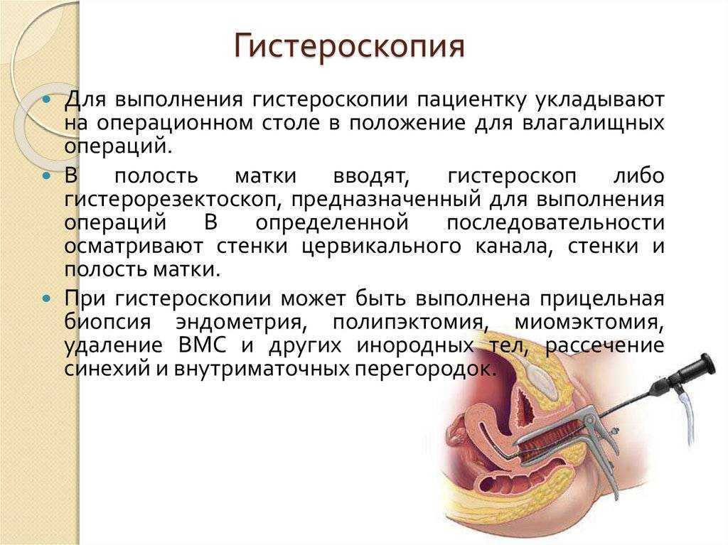Полипы желудка — surgery-first.ru