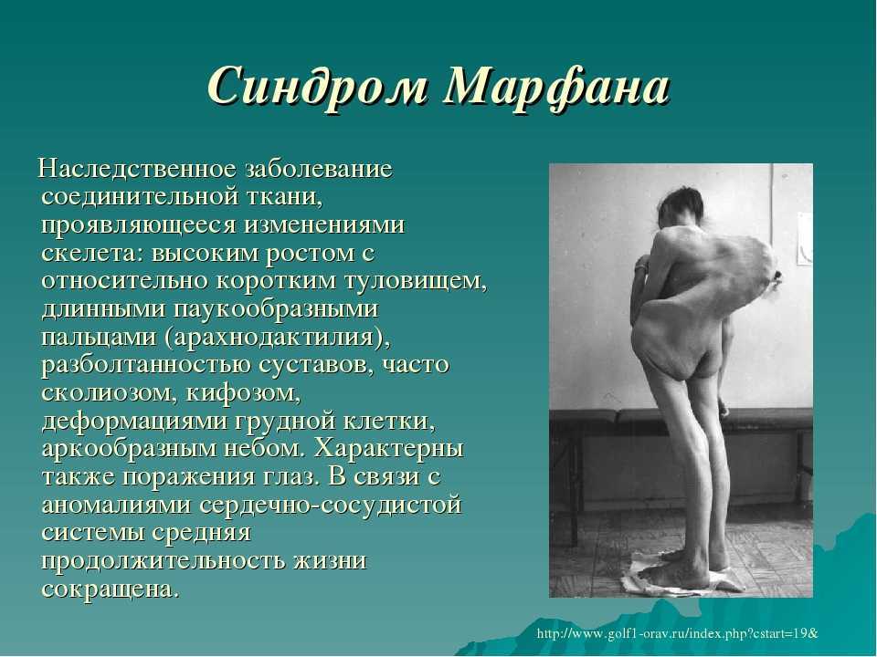 Гравитационный птоз: что это такое и как с ним бороться