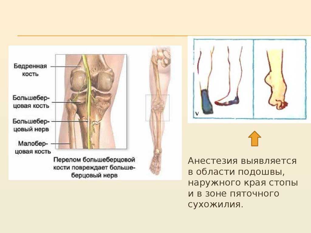 Заболевания периферических нервных стволов и сплетений