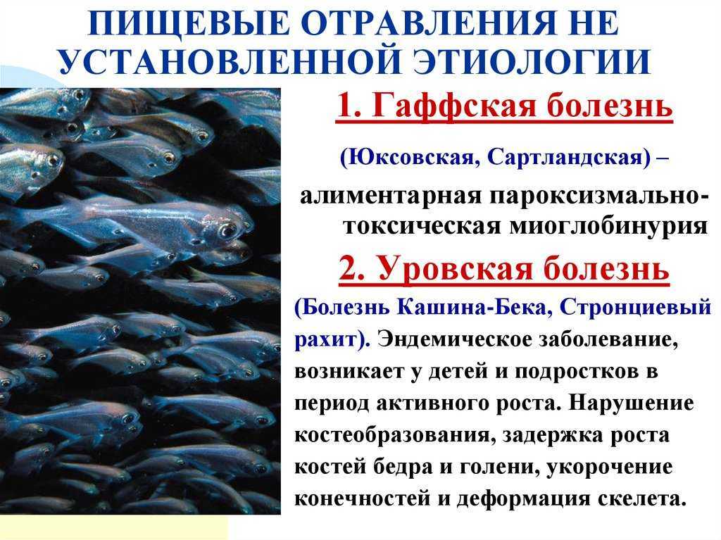 Инфекции мочевыводящих путей: симптомы, причины, факторы риска и диагностика