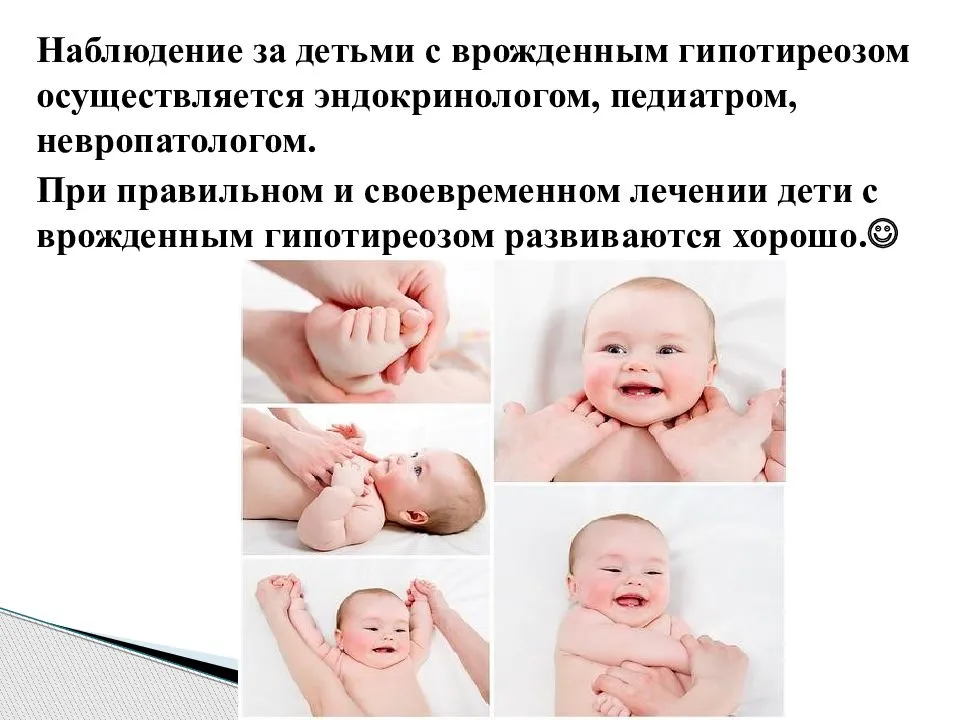 Гипотиреоз у детей клинические. Врожденный гипотиреоз у детей. Врожденный гипотиреоз симптомы. Врождённый гипотиреоз клинические признаки. Гипотиреоз у новорожденного.