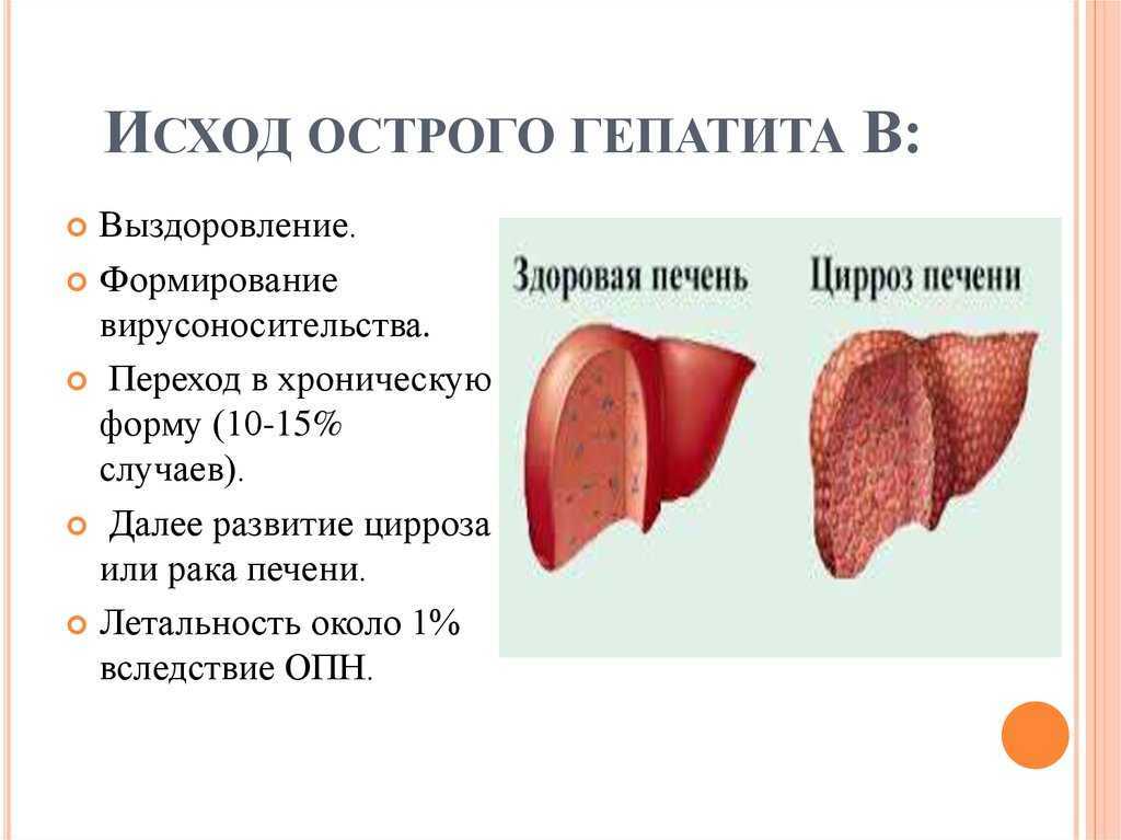 Гепатит обычный. Острая и хроническая формы гепатита. Фазы хронического гепатита b. Исходы острого вирусного гепатита. Стадии острого вирусного гепатита.