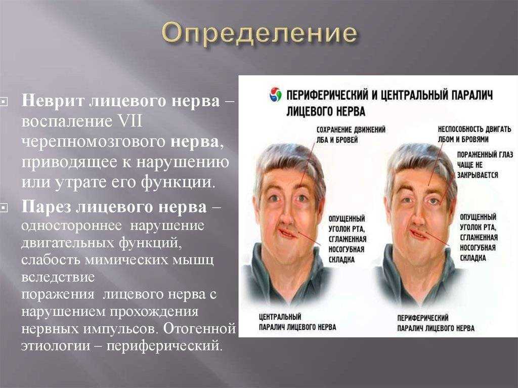 Коррекция ушных раковин. причины лопоухости у детей | 1дмц