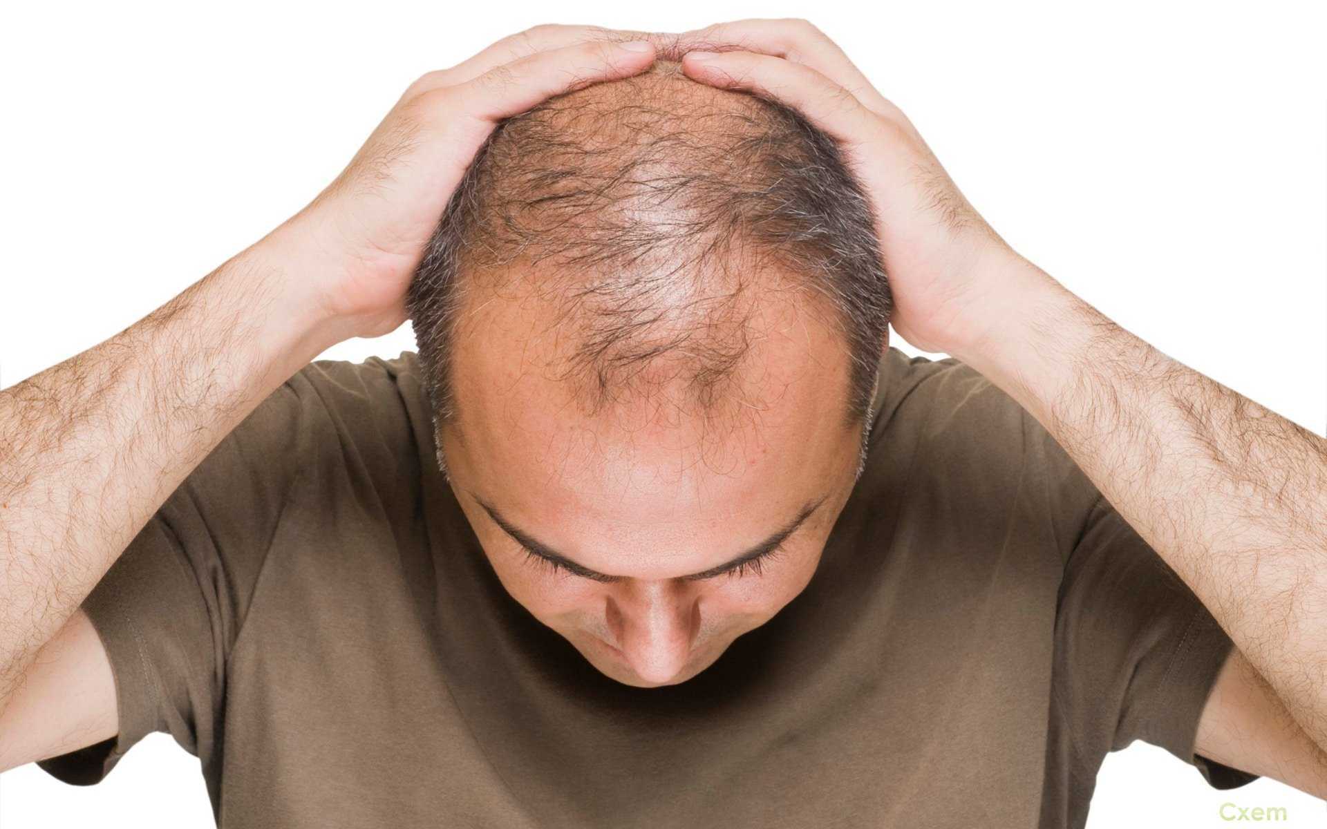 Que tomar para la alopecia por estres