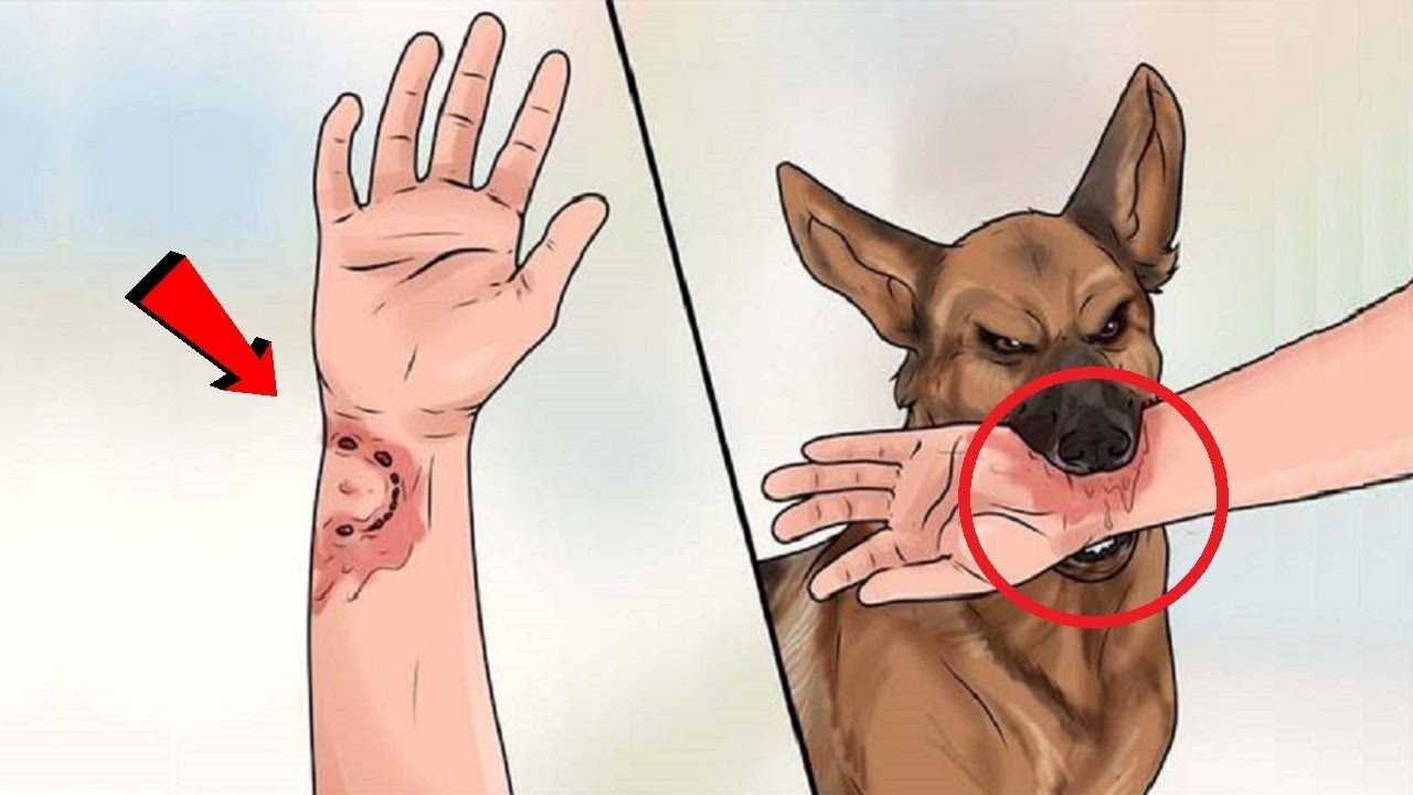 Помощь при укусе собаки