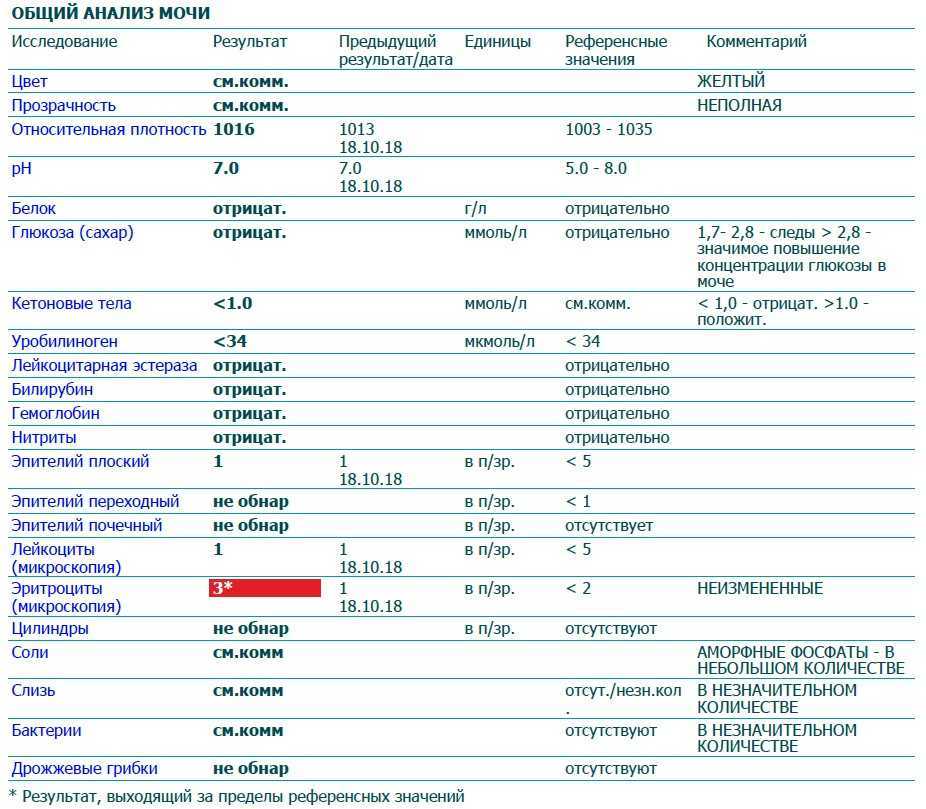 Плоский в моче у ребенка. Расшифровка анализа мочи лейкоциты 2- 1 1. Норма лейкоцитов в моче у подростков. Анализ мочи лейкоциты 1. Анализ мочи эритроциты норма у женщин.