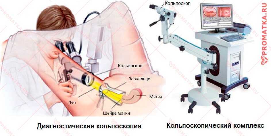 Кольпоскопия шейки матки что это. Строение кольпоскопа.