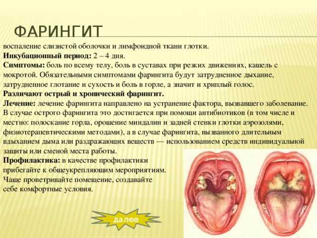 Лечение фарингита у детей - 25 лекарственных средств: как лечить ринофарингит, гранулезный, назофарингит, острый вирусный, сколько держится температура