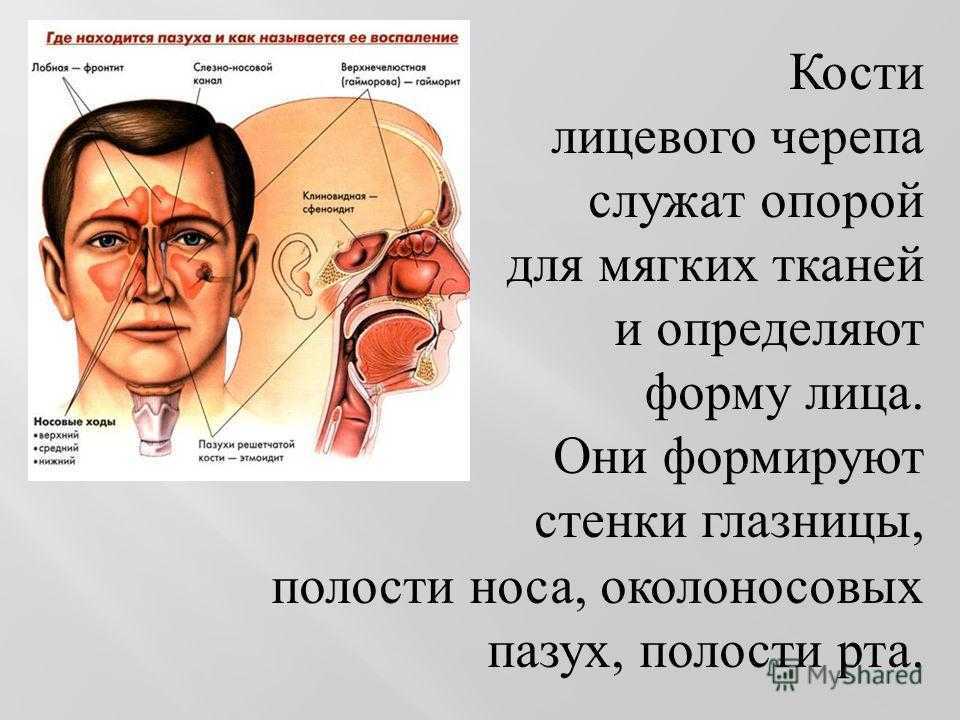 Пазуха. Гайморова пазуха расположена в кости. Пазухи черепа воспаления. Гайморова пазуха располагается в.