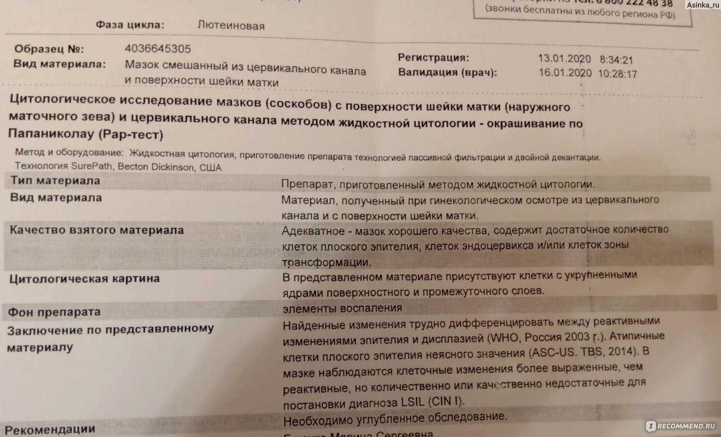 Анализ у женщин гинекология. Жидкостная цитология шейки матки. Жидкостное цитологическое исследование шейки матки. ВПЧ шейки матки цитология. Заключение цитологического исследования шейки матки.