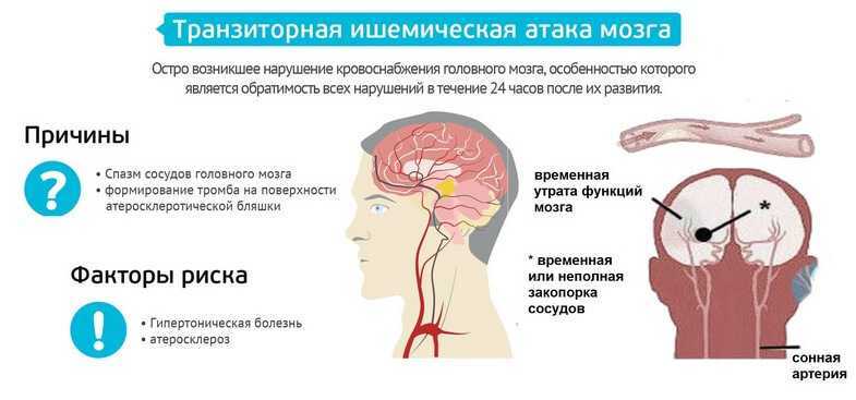 Анатомия среднего мозга человека – информация: