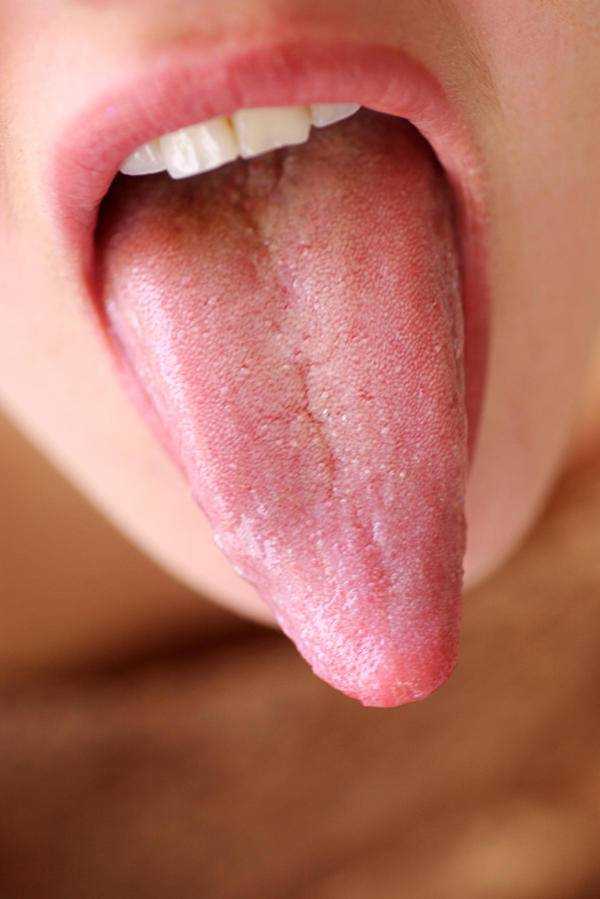 Нарушение речи — чем может быть вызван этот симптом?