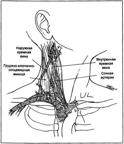 Яремная вена на шее где находятся у человека фотографии