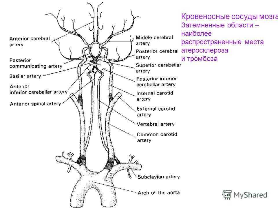 Брахиоцефальные артерии