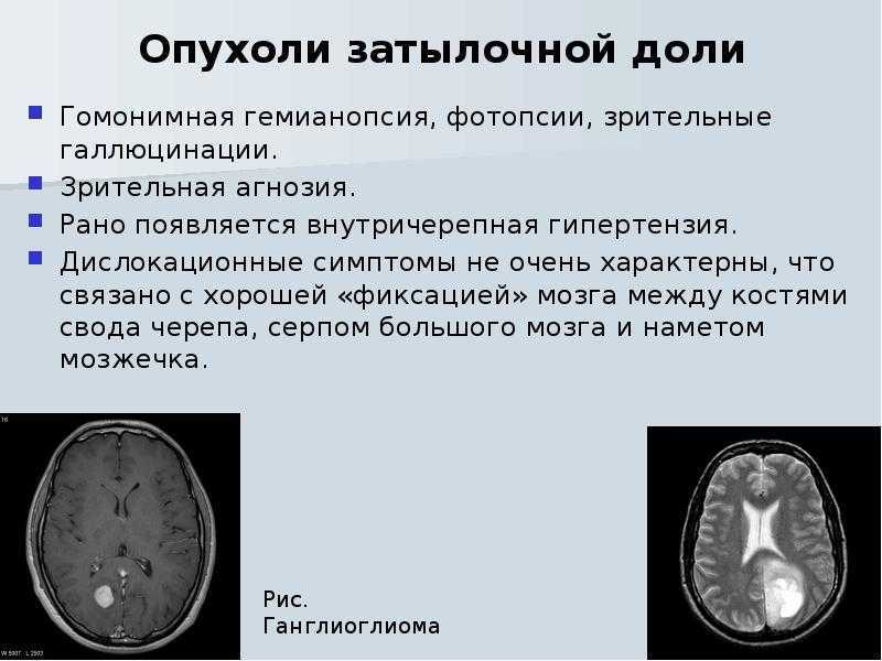 Височная доля головного мозга