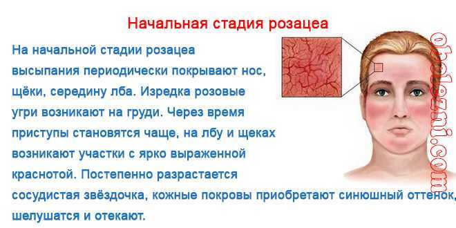 Розовый лишай (болезнь жибера). тревожные симптомы и эффективное лечение