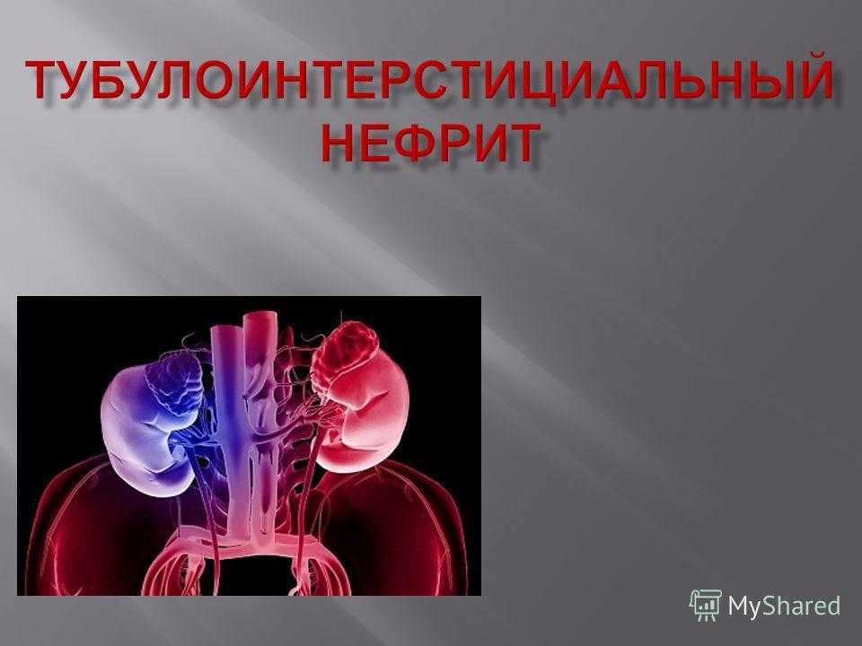 Острый тубулоинтерстициальный нефрит что это у женщины