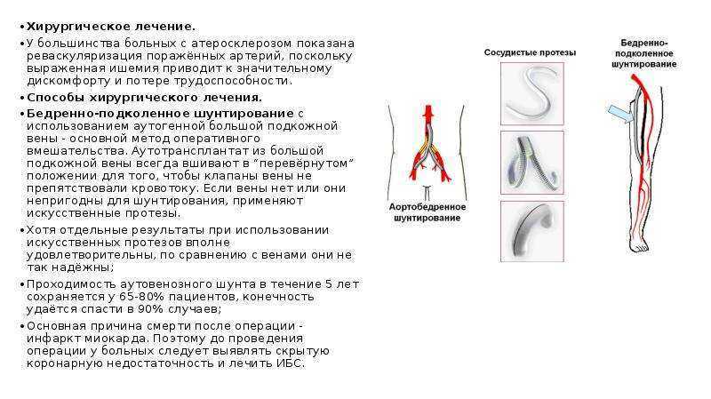 Окклюзия подколенной артерии