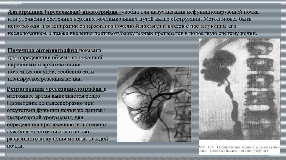 Допплерография – что такое допплеровское исследование? когда оно проводится?