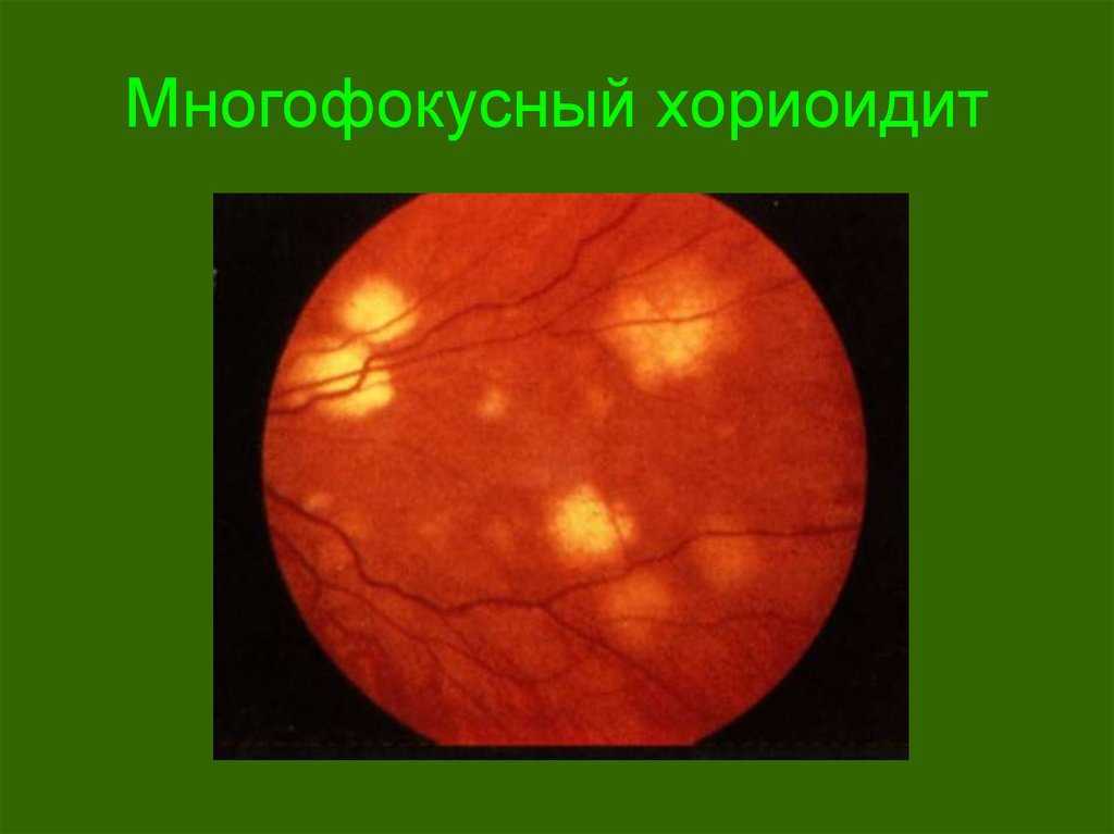 Строение глаза человека | цмхг макарчука