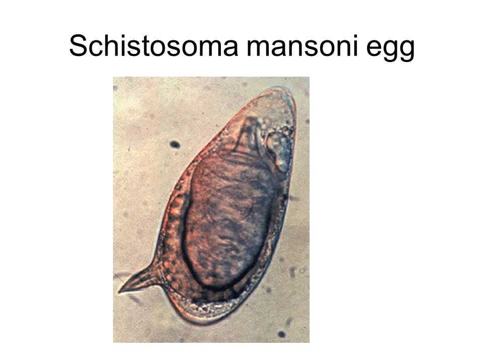 Заболевание вызванное сосальщиком. Кровяной сосальщик шистосома. Schistosoma mansoni яйца. Шистосома Мансона s. mansoni. Шистосома Мансона (Schistosoma mansoni.