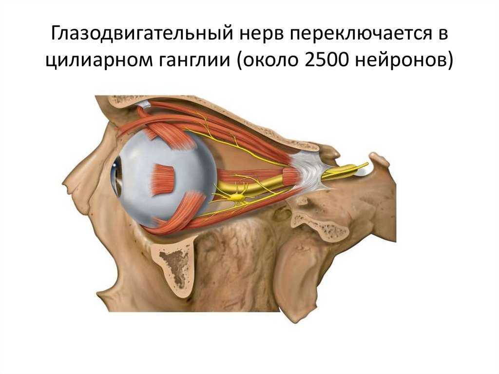 Способ хирургического лечения паралитического косоглазия при   поражении глазодвигательного нерва