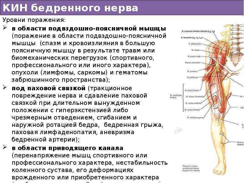 Где находится седалищный нерв у человека фото и как болит и лечение симптомы у женщин