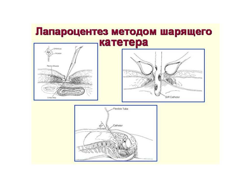 Повреждения