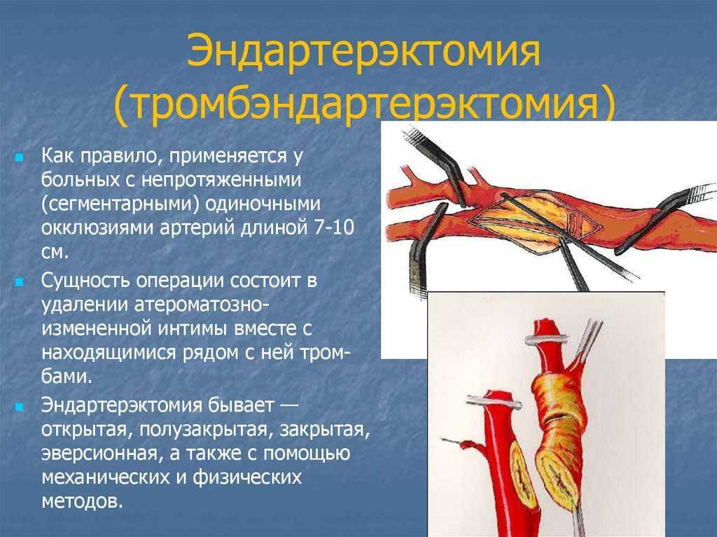 Артерии человека | анатомия артерий, строение, функции, картинки на eurolab