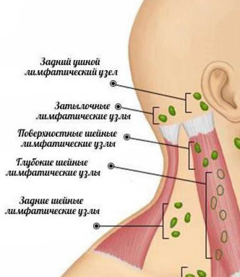 Лимфатические узлы на шее расположение у женщин фото